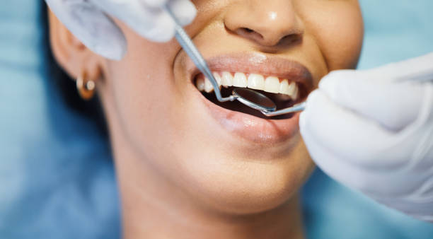 Best Emergency Wisdom Teeth Removal in Simmesport, LA