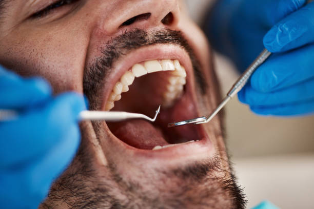 Best Emergency Gum Treatment in Simmesport, LA